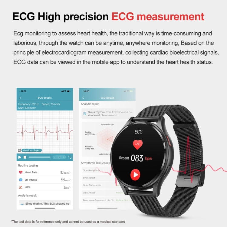 1.43 inch Silicone Strap Bluetooth Call Smart Watch Support ECG / Non-invasive Blood Sugar�������...