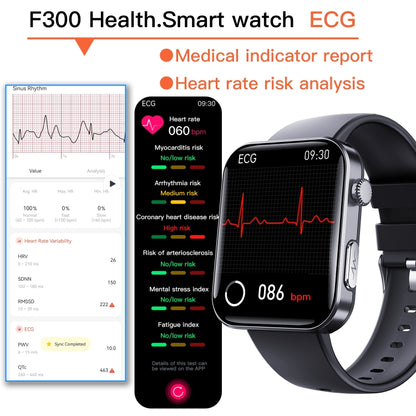 F300  2.1-Inch Screen Smart Watch Supports Bluetooth Calls/ECG/Blood Composition Analysis/50+ Spo...